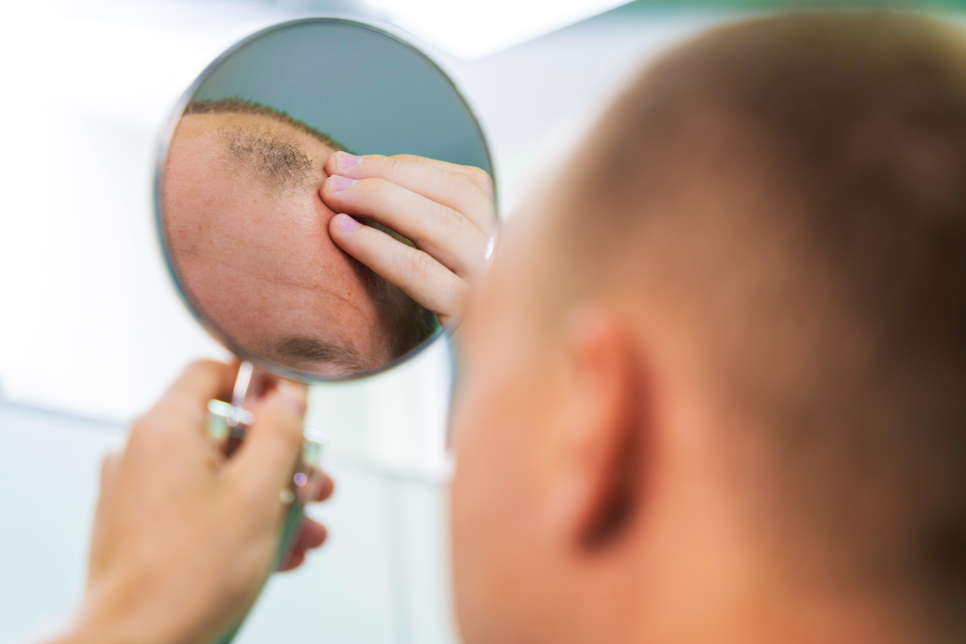 Bald Alternative